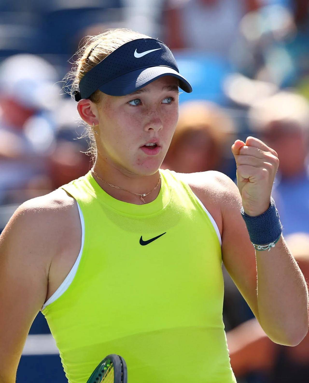 多活塞卡钳 多活塞卡钳